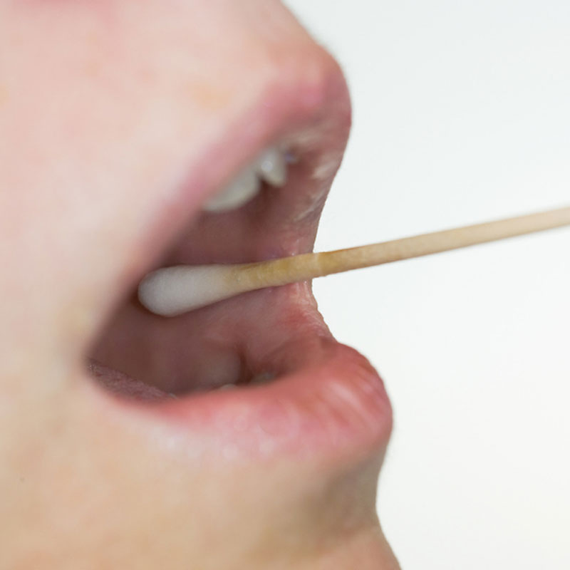 Tonsillitis test